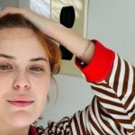 Дочь Брюса Уиллиса и Деми Мур шокировала последствиями неудачной косметологической процедуры