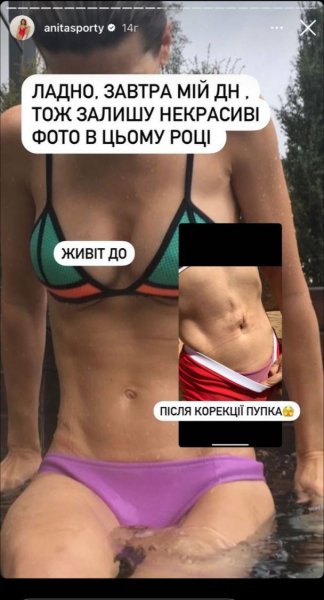 
Анита Луценко в слезах шокировала, как неудачная операция испортила ей вид живота, и показала фото
