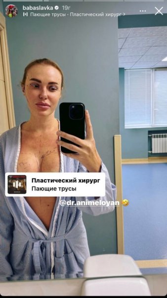 
Слава Каминская сделала пластическую операцию на груди и лице и показала первые кадры из больницы
