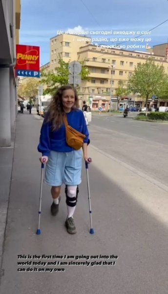 
Елена Шоптенко после операции на ноге показала, как проходит ее реабилитация: "В колене теперь крюк"
