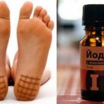 Что будет, если на ночь мазать пятки йодом: ответ многих удивит