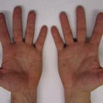 Почему у людей 5 пальцев на руках, а не 6: объяснение ученых